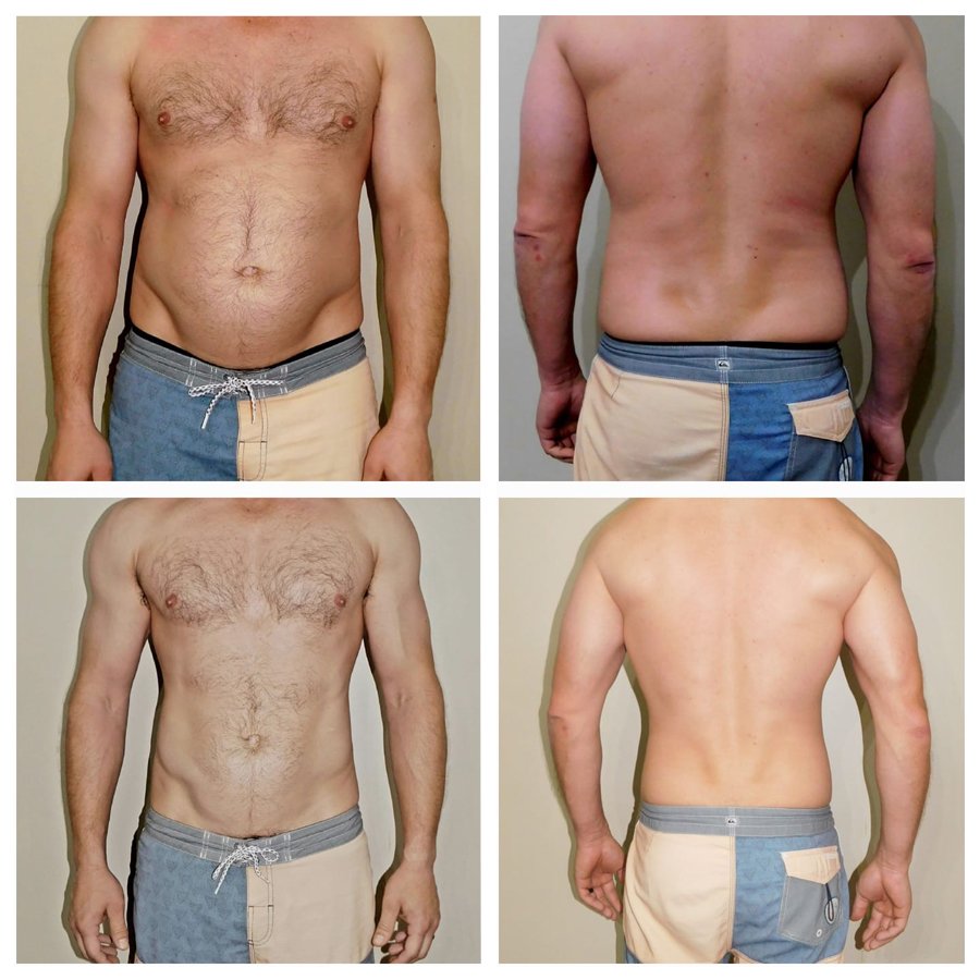 Client 6 — Front & Back Progress